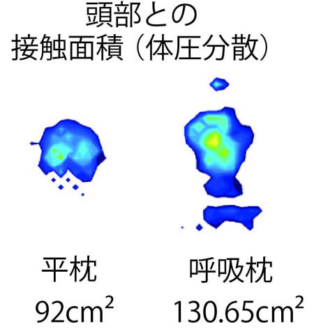 頭部との接触面積