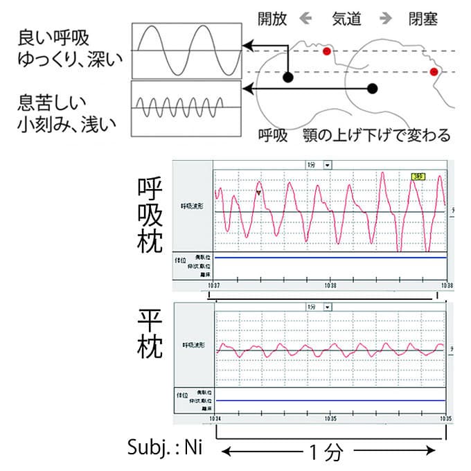 呼吸の標準パターン